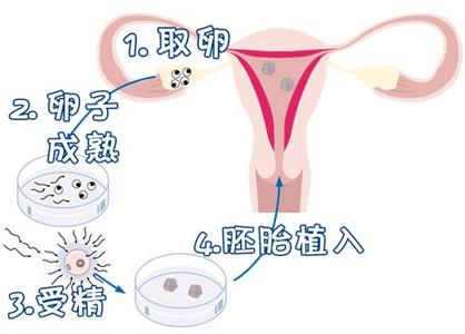 同性借卵助孕包生儿子